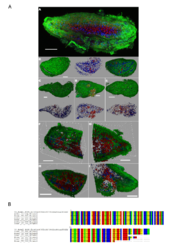 Acoel flatworm microscopy images and alignment of V9 sequence